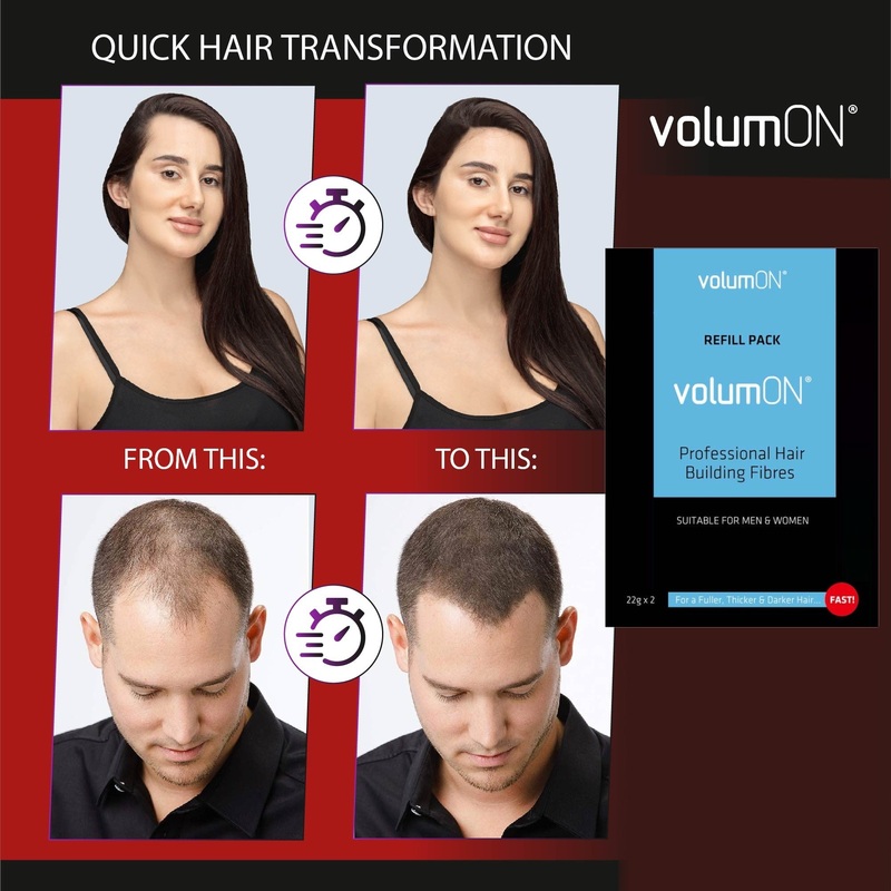 Volumon Unisex Hair Loss Concealer Refill Packs  22g (Single or Double Pack)  Free UK Delivery Light Brown 22g Pack x1