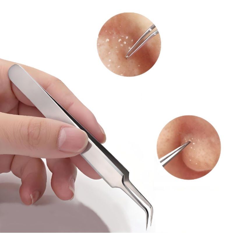 Glamza Blackhead Removal Straight Tweezer  Professional Precision for Clearer Skin – FREE POSTAGE x1