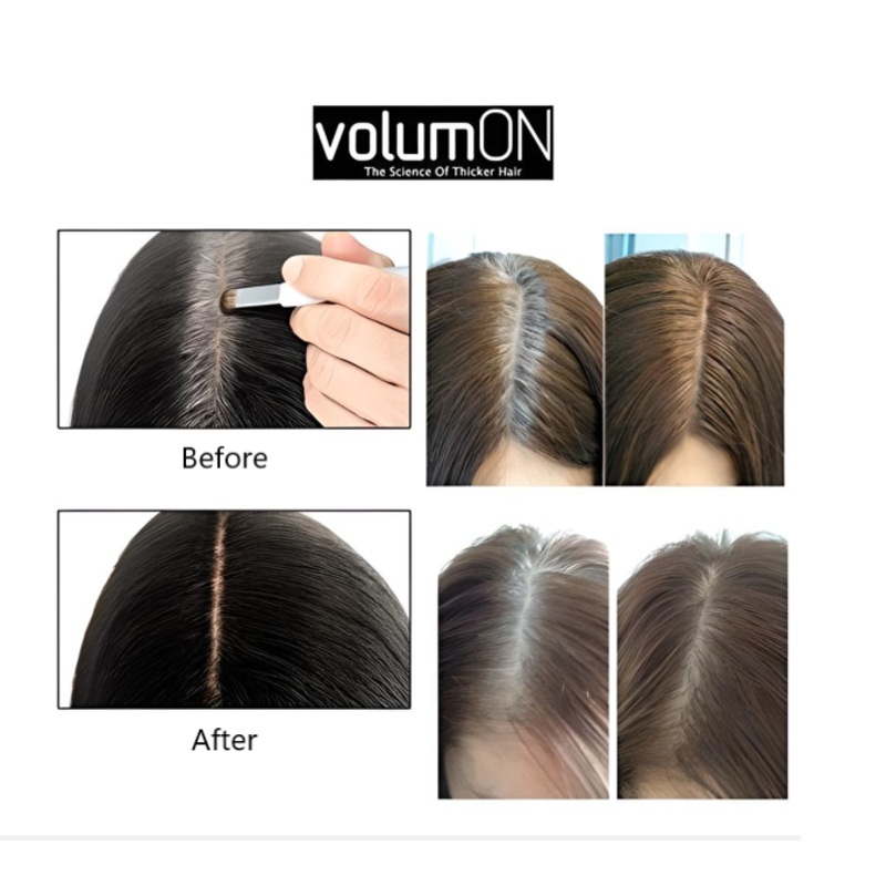 Volumon Hair Loss Concealer & Root Cover Up Kit  Fuller Hair with Free UK Delivery Black